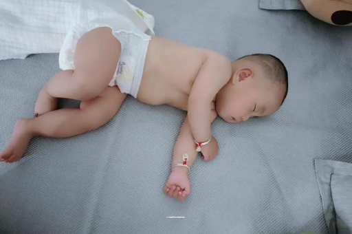 雄安新区六个月宝宝眼睛散光